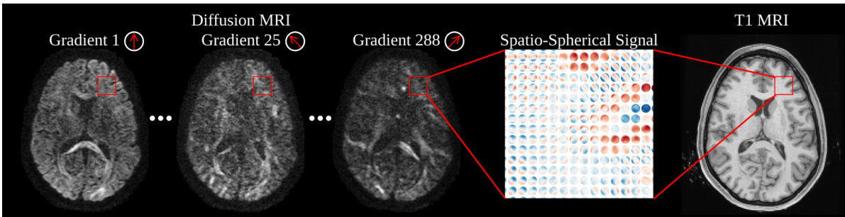 Equivariant spatio-hemispherical networks for diffusion MRI ...